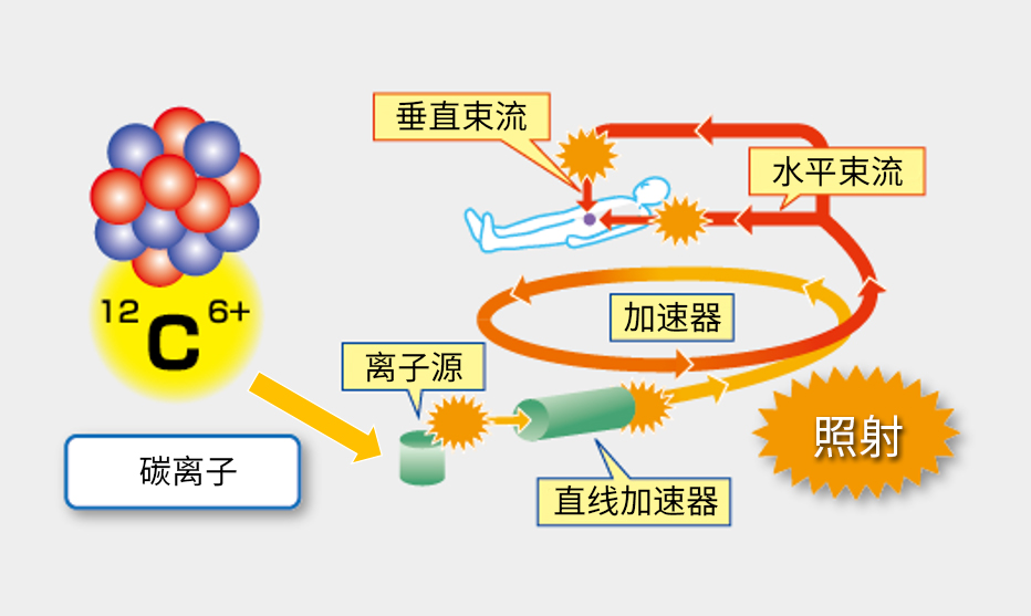 碳離子照射設備